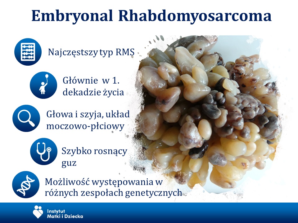 Wycięty guz Embryonal Rhabdomyosarcoma